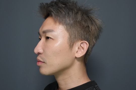 After